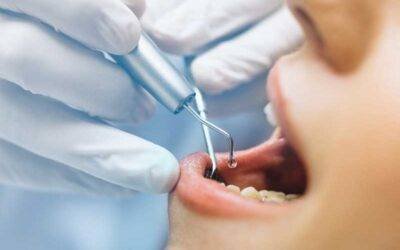 How Much Does Teeth Cleaning Cost in Weston, FL? [2026 Guide]