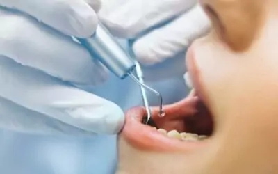 How Much Does Teeth Cleaning Cost in Weston, FL? [2026 Guide]