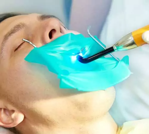 Dental-Bonding-Cosmetic-Dentistry-Dentist-in-Weston-FL Dental-Bonding-Cosmetic-Dentistry-Dentist-in-Weston-FL