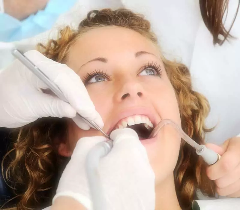Dental-Fillings-Restorative-Dentistry-Dentist-in-Weston-Fl Dental-Fillings-Restorative-Dentistry-Dentist-in-Weston-Fl