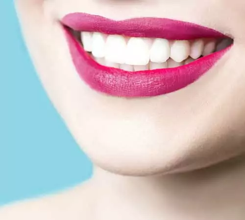 Teeth-Whitening-Cosmetic-Dentistry-Dentist-in-Weston-FL Teeth-Whitening-Cosmetic-Dentistry-Dentist-in-Weston-FL