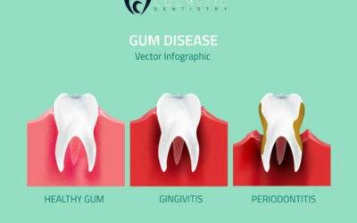 Know more about Gum Disease