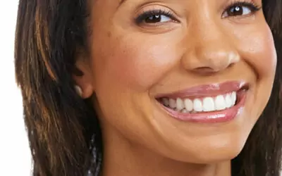 Are porcelain veneers permanent?