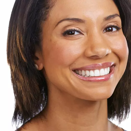 Are porcelain veneers permanent?