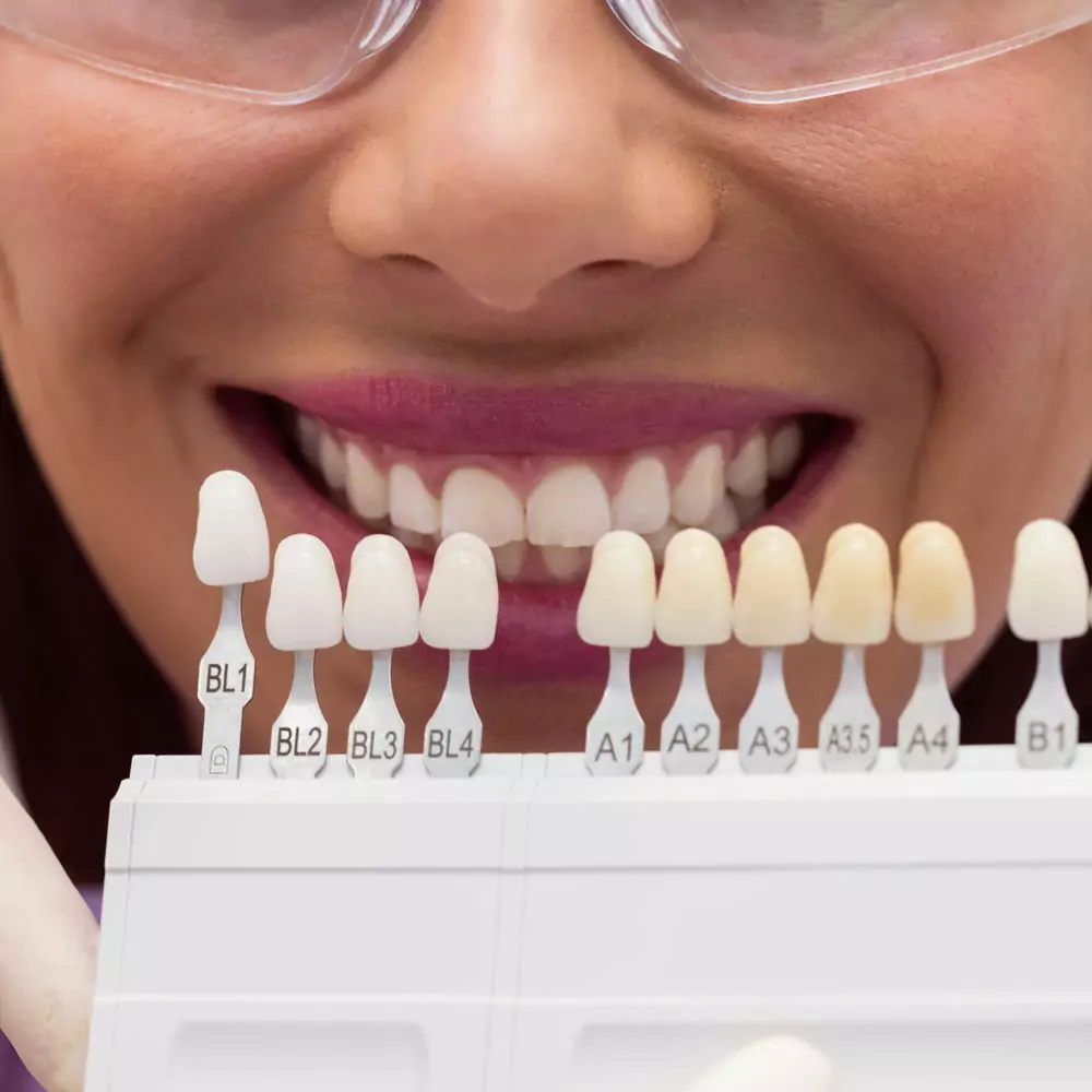 Tellgo. Teeth Impression Molding Kit.