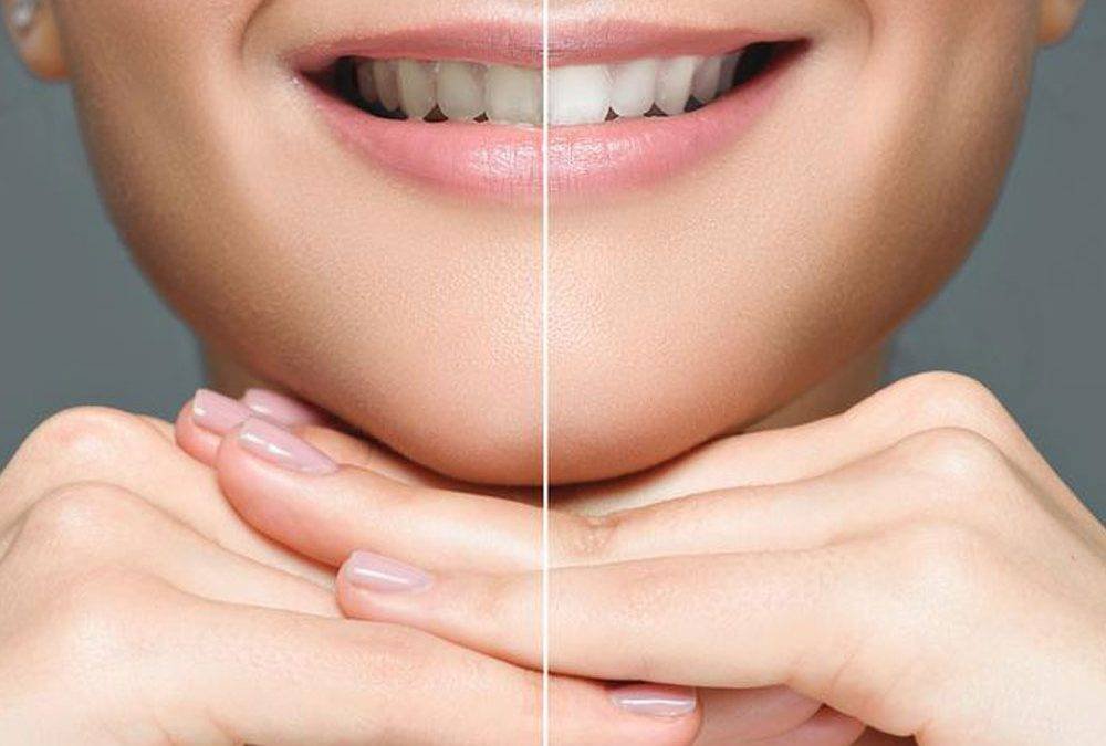 Does whitening toothpaste damage teeth?