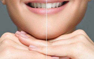 Does whitening toothpaste damage teeth?