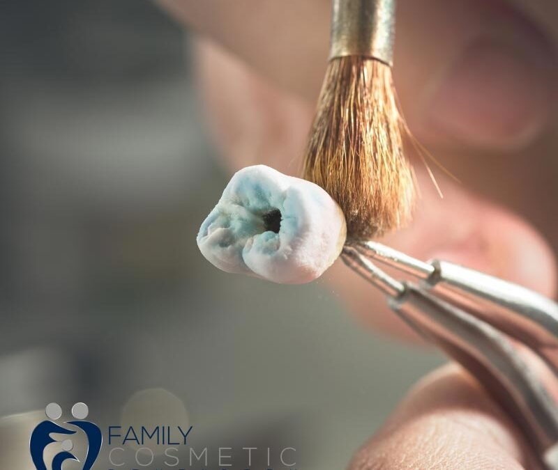 What Is Tooth Polishing? Everything You Need to Know for a Healthier, Brighter Smile